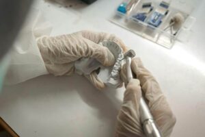 invisalign versus veneers