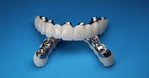 how dental implants are done